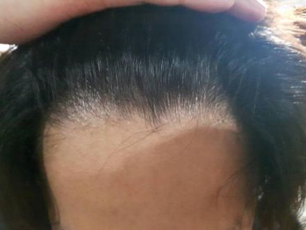 【JFN PARK限定企画】ROOT FIVEフォト企画『ルーファイ　モンタージュ！！』