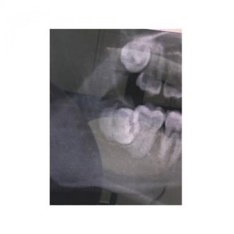 藤井悠のいただき！ハッ！