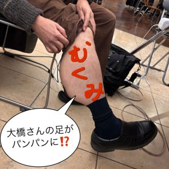 むくみ
