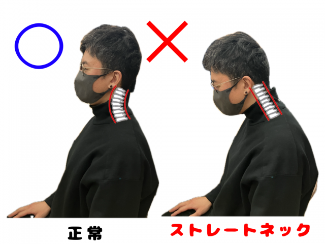 ストレートネック